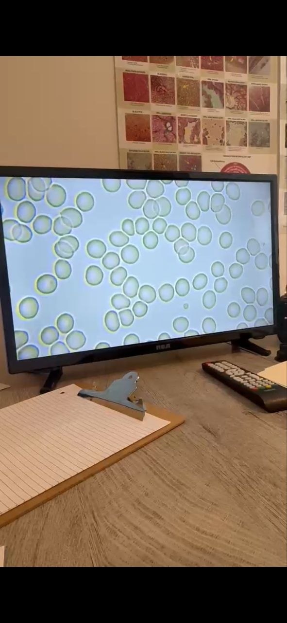 Red blood cells after 5 weeks of ERW water, freely moving and round