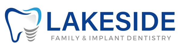 Lakeside Implant Dentist