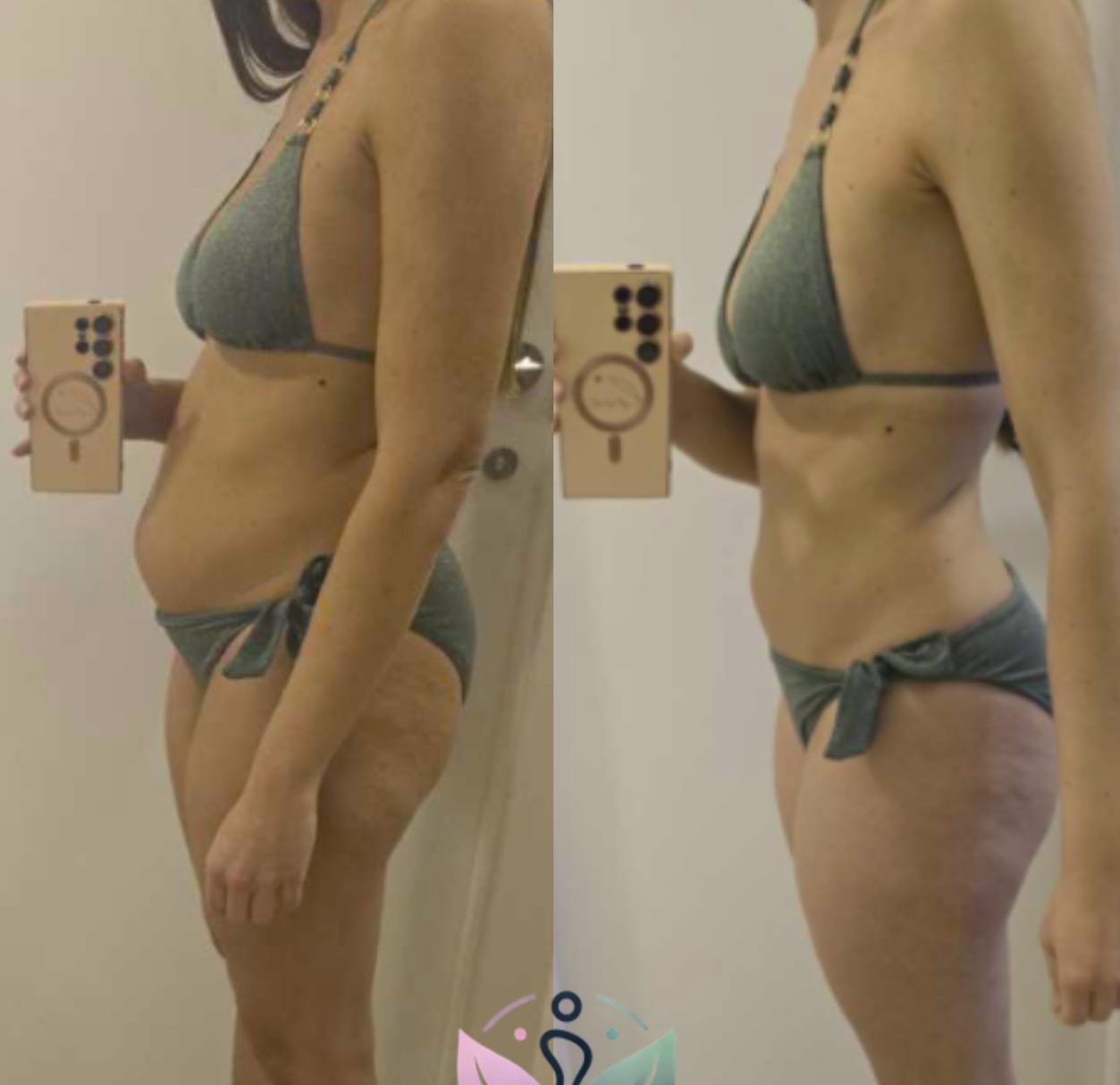 Antes y después de Carla