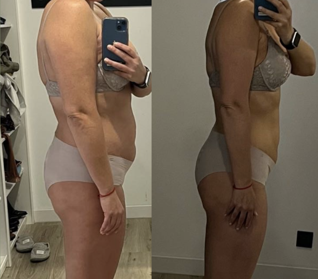 Antes y después de Angie