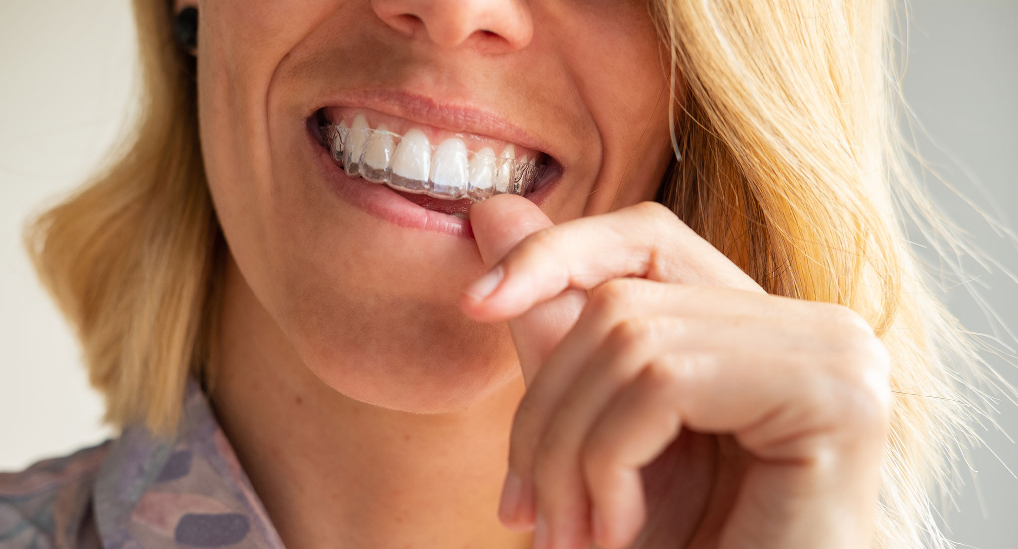 Woman holding invisalign