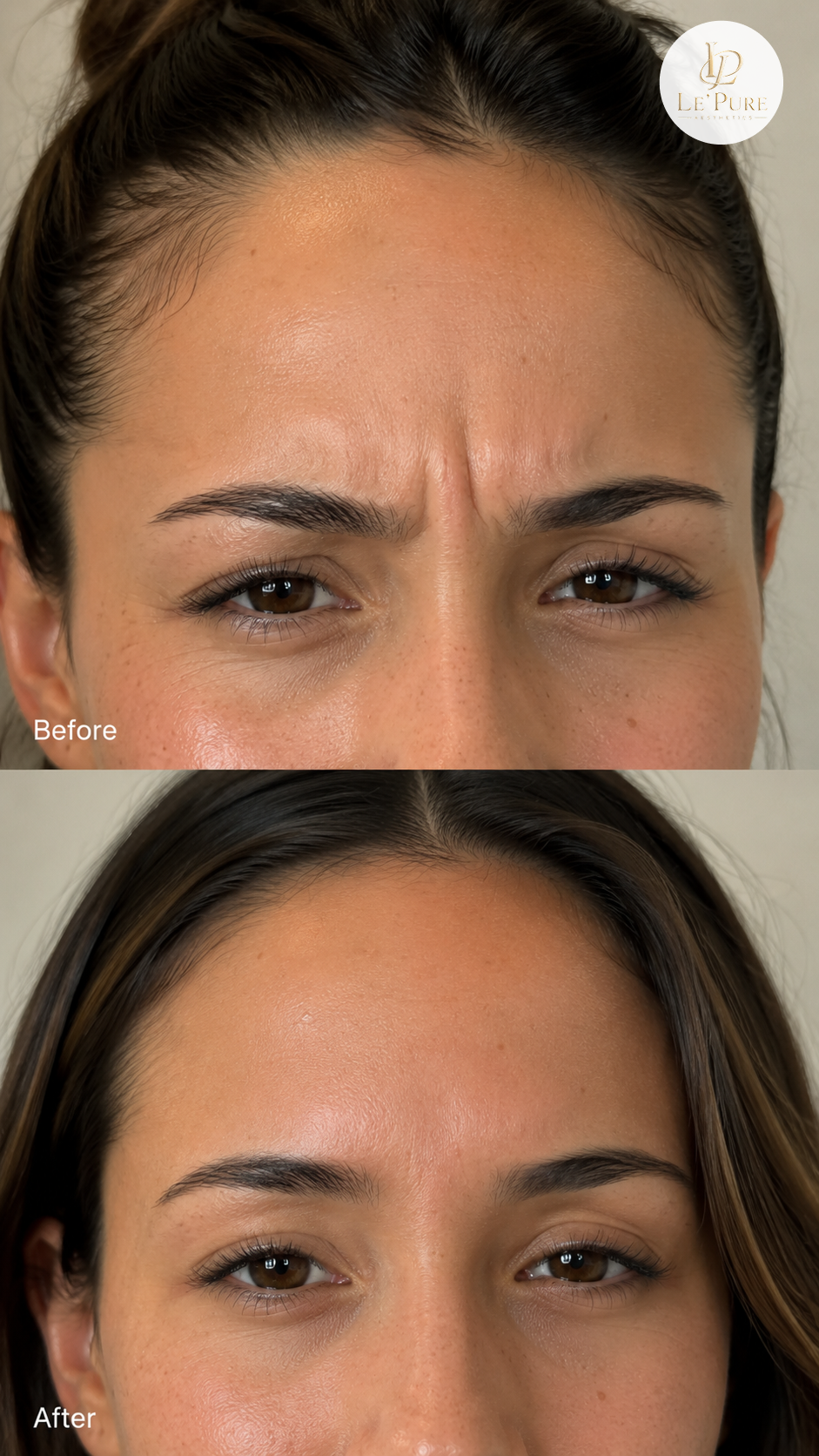 Le’Pure treatment comparison 5, before and after