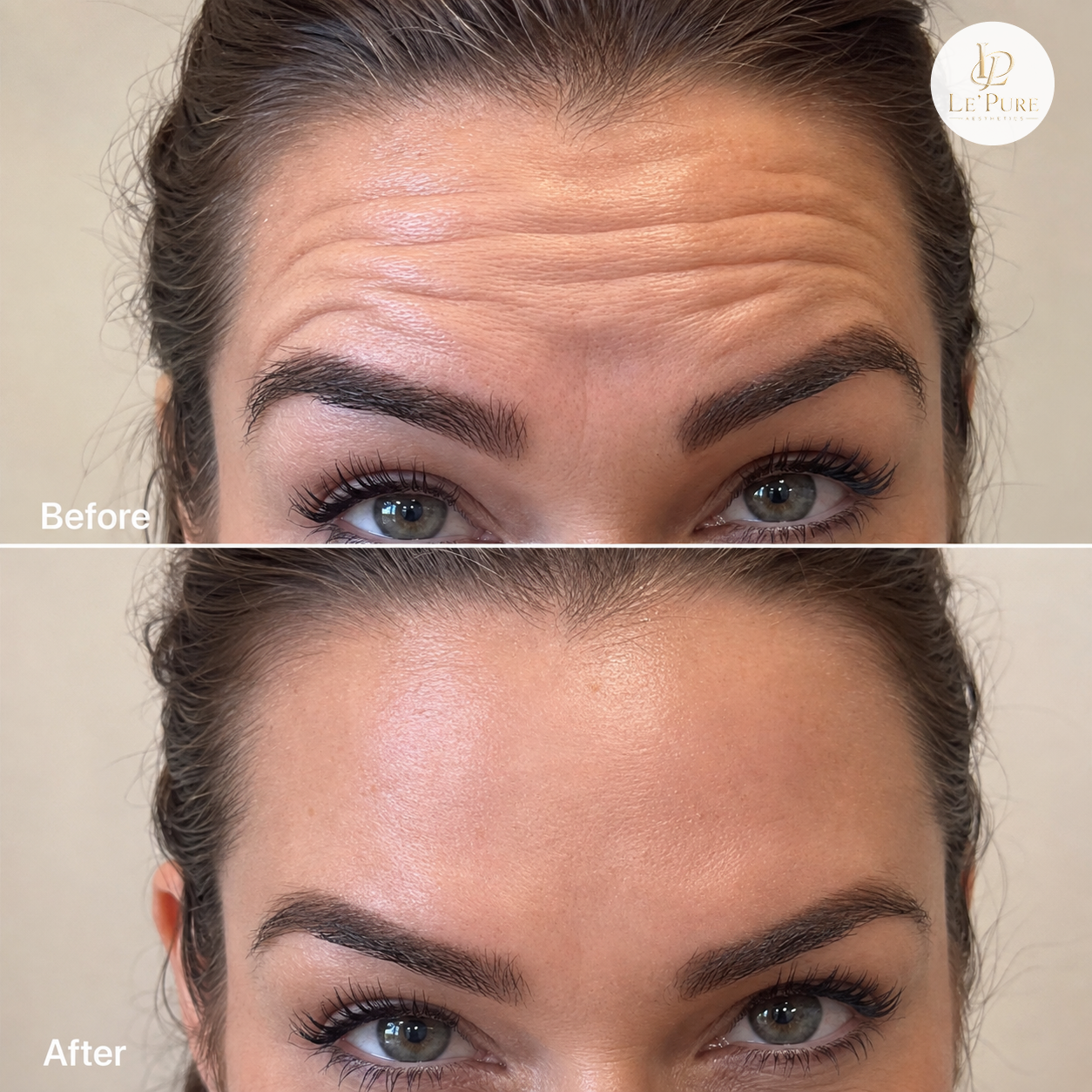 Le’Pure treatment comparison 1, before and after