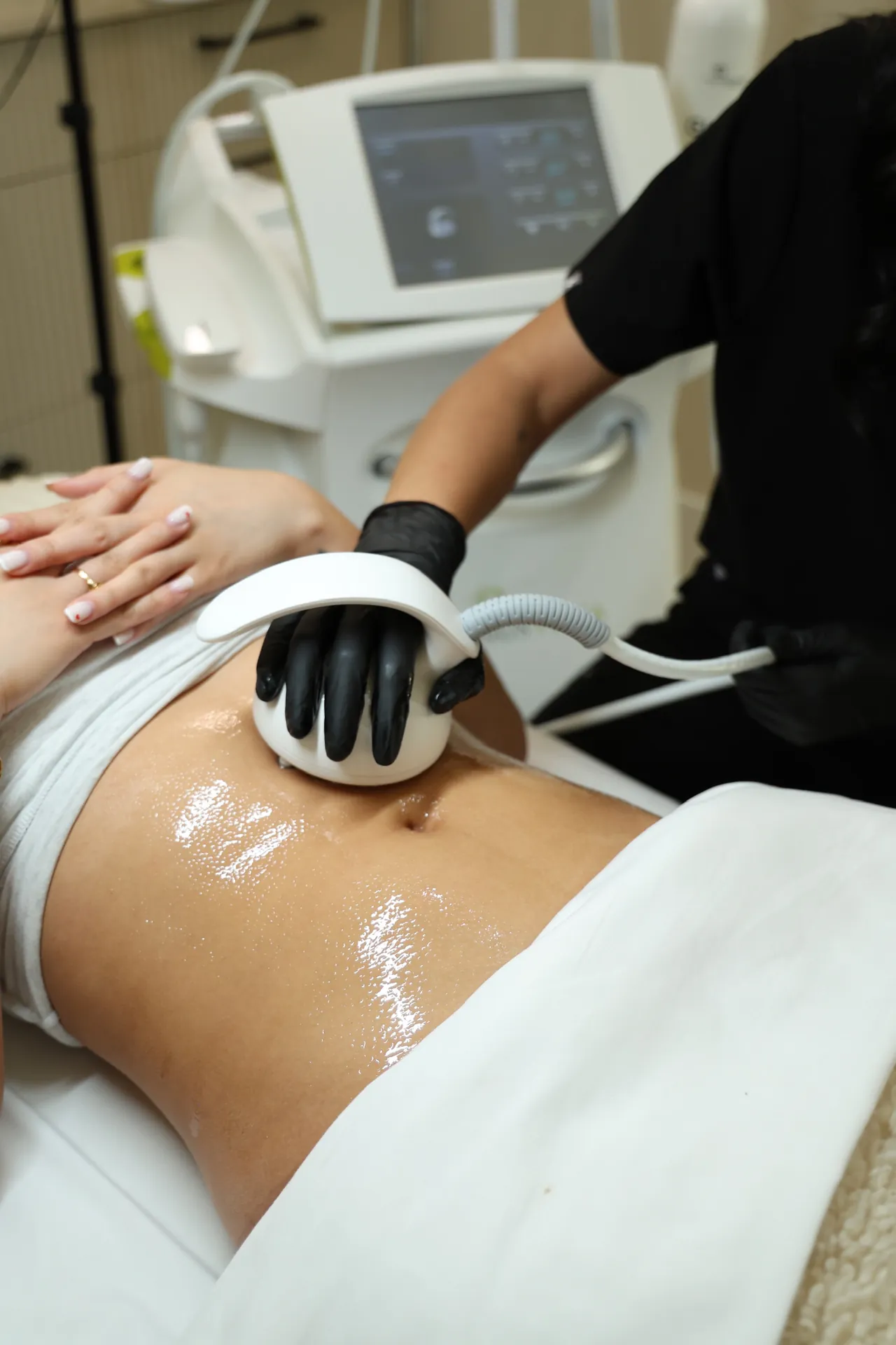 Skin tightening treatment at Derma Lounge Aesthetics in Surrey