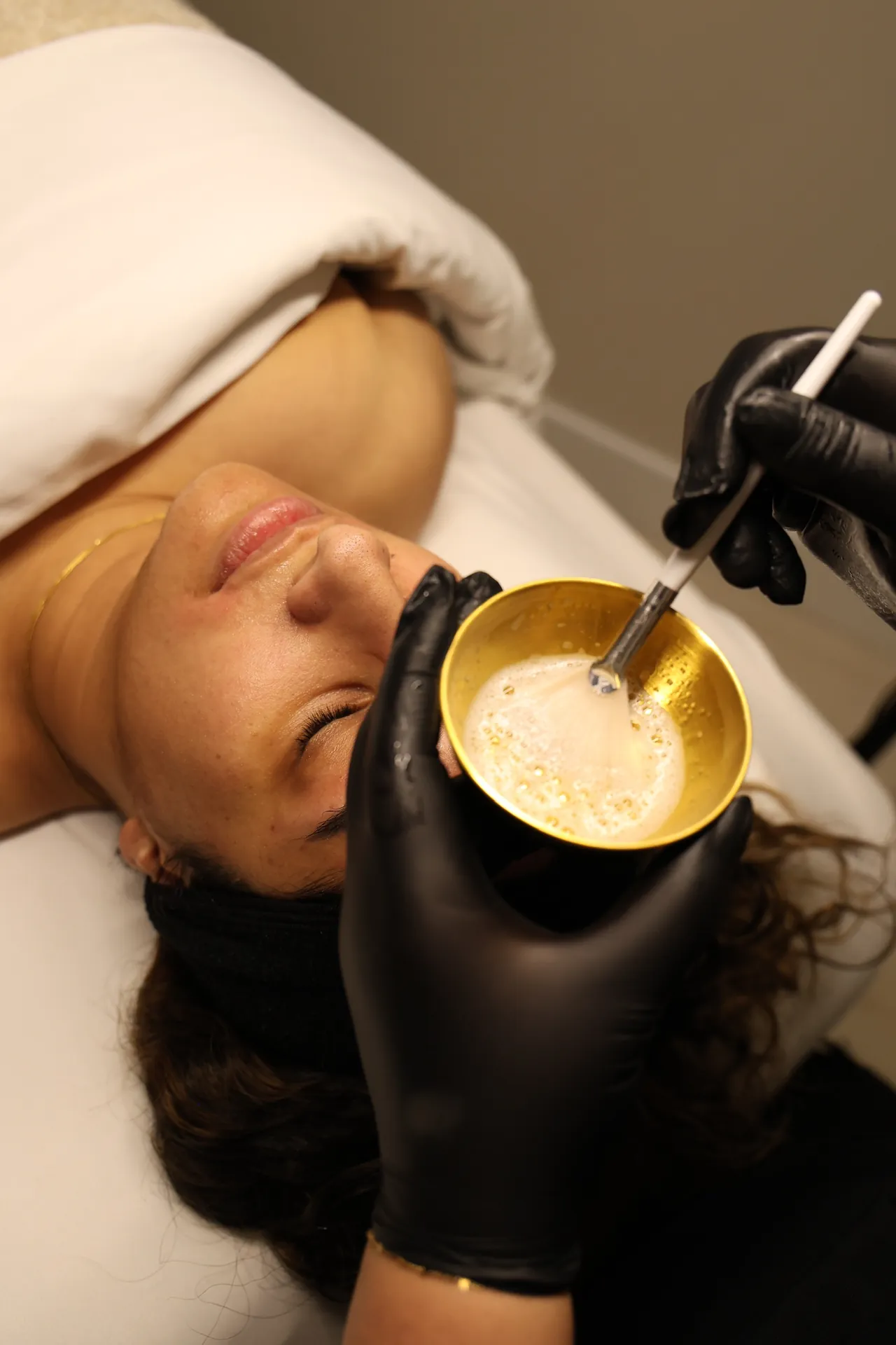 Skin booster treatment at Derma Lounge Aesthetics in Surrey