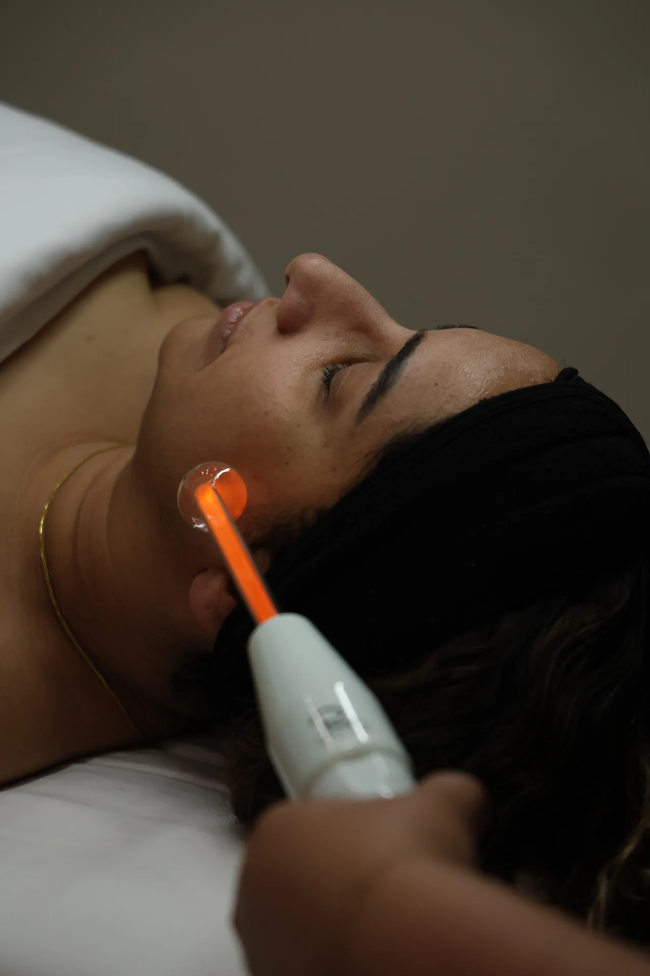 IPL photofacial at Derma Lounge Aesthetics in Surrey