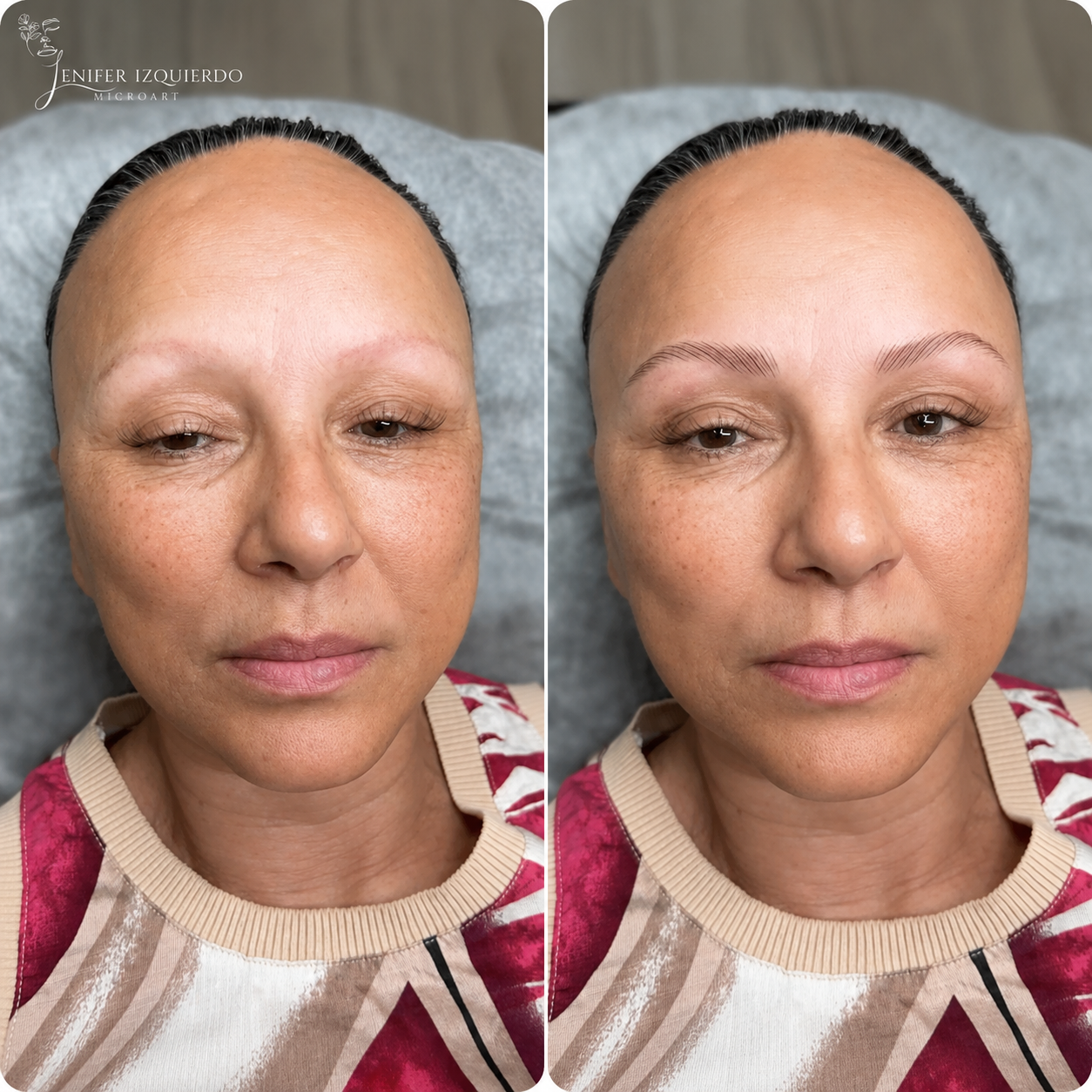 Antes y después micropigmentación hiperrealista