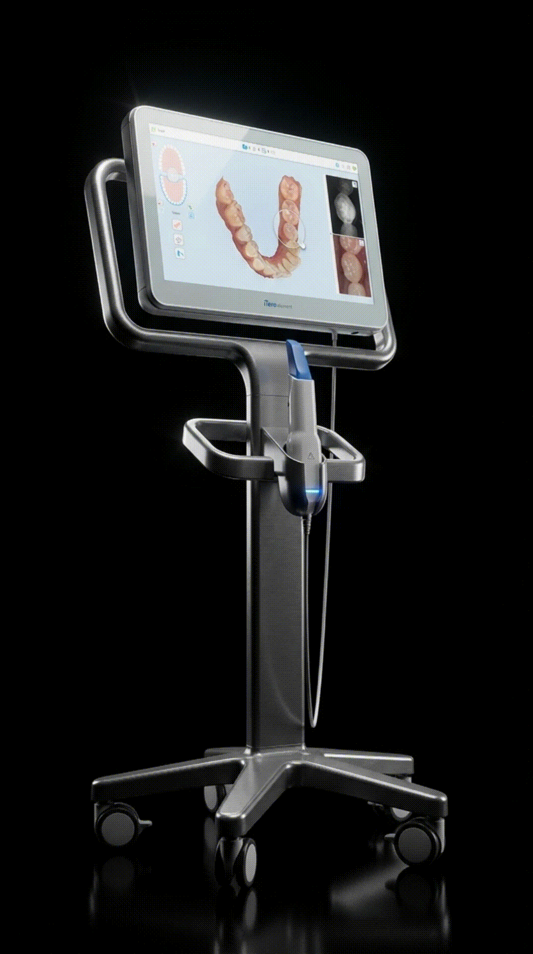 Escaneo 3D con iTero — diagnóstico digital previo al tratamiento Invisalign con la Dra. Gloria Rivera