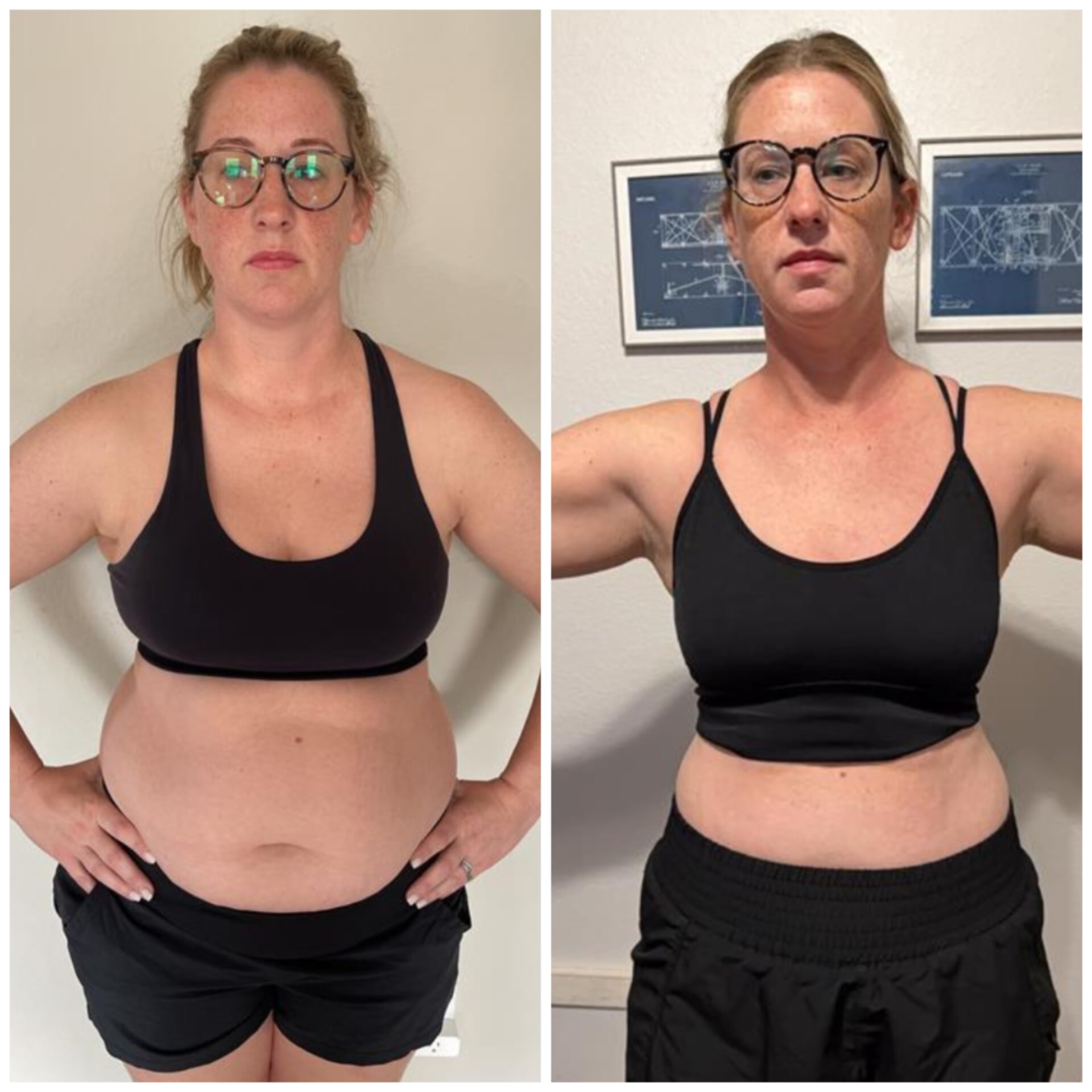 Brittany before and after