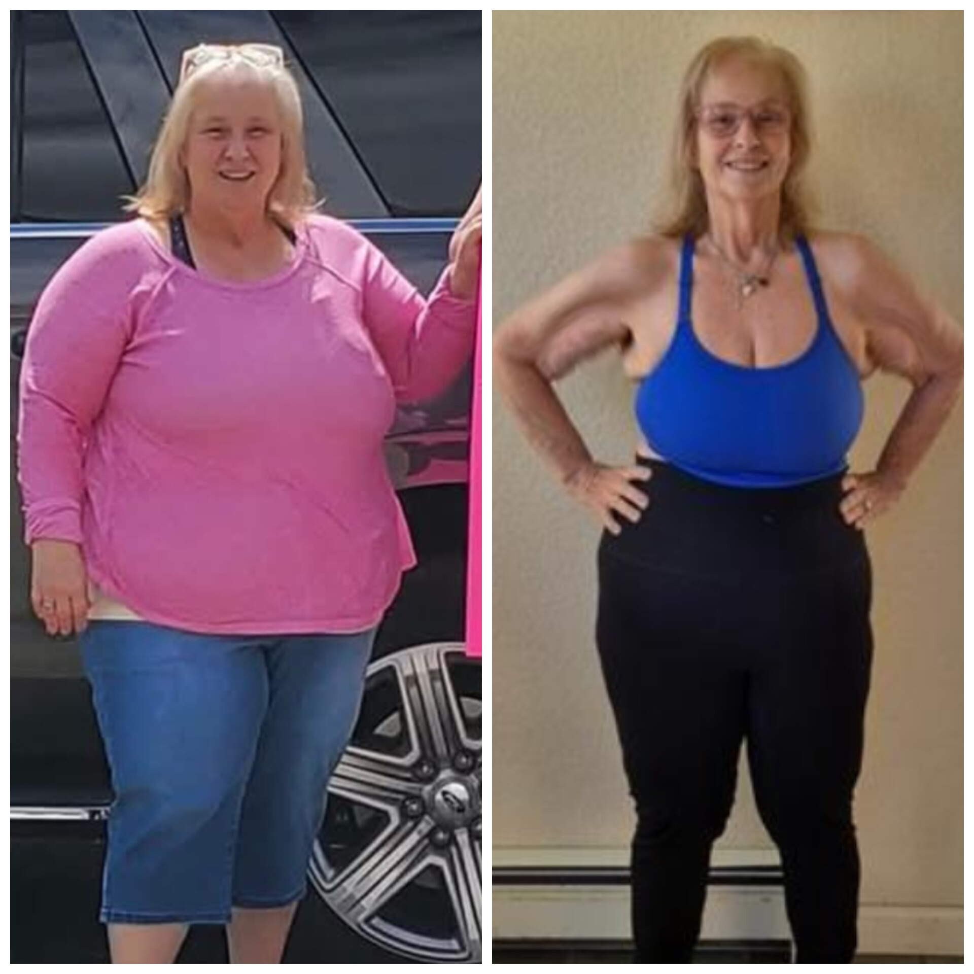 Susan before and after