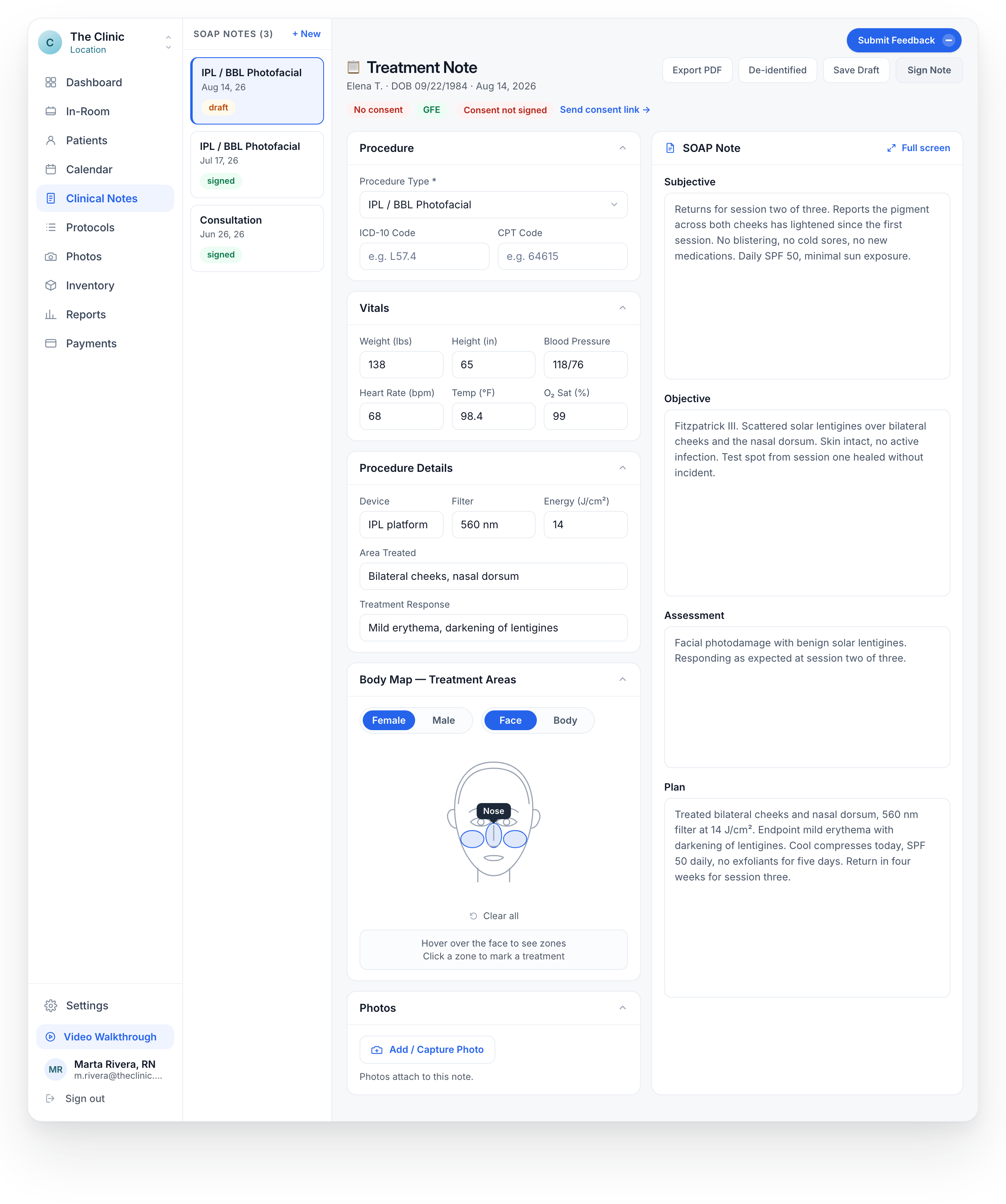 A draft note with procedure details, vitals, SOAP sections, a body map and displayed consent status.
