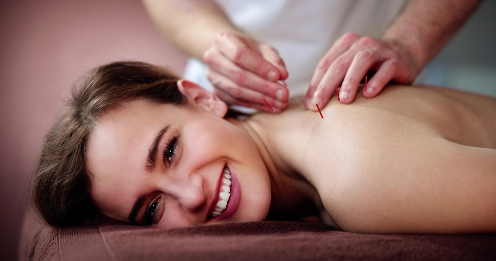 A woman smiles during an acupuncture treatment.