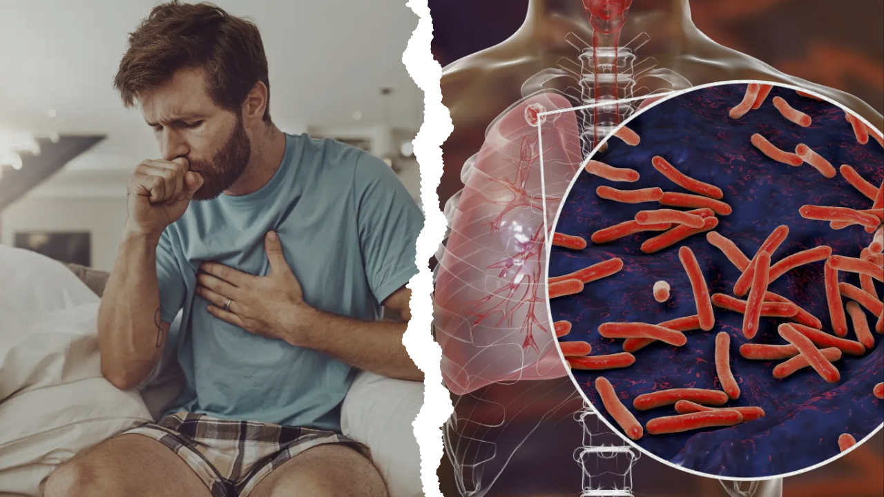 'WHITE PLAGUE' BEGINS TO RISE IN THE U.S., NOW DEADLIER THAN COVID