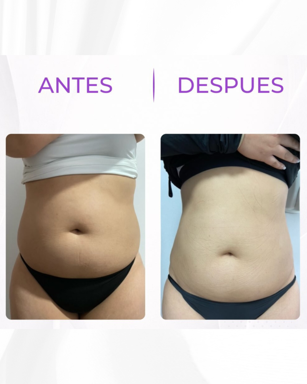 Antes y después · tras 6 sesiones