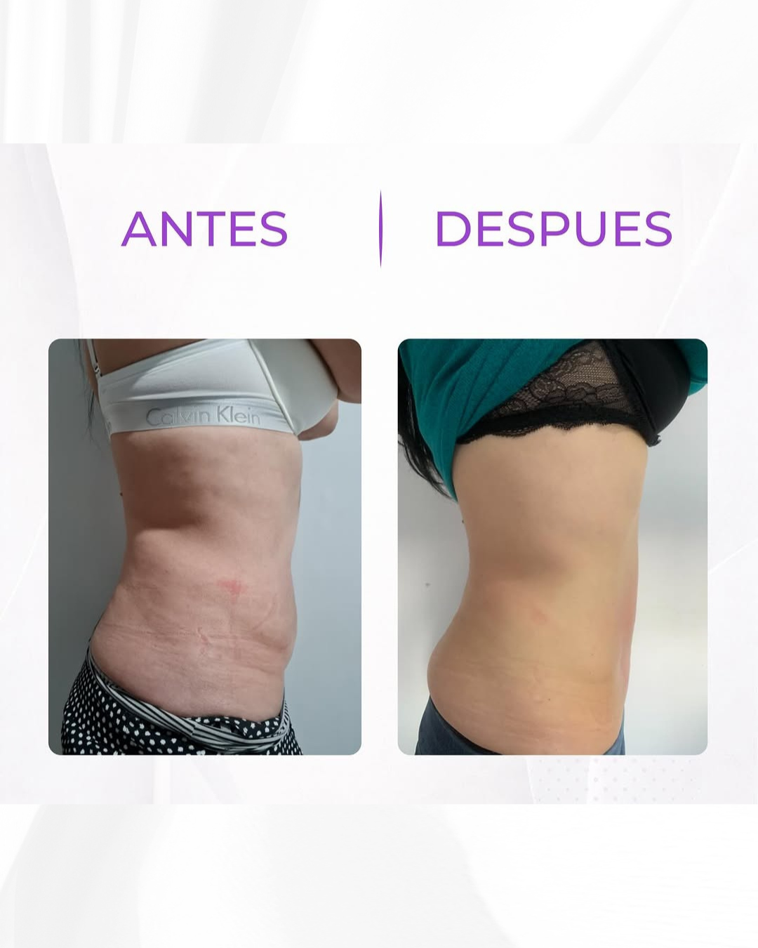 Antes y después · tras 6 sesiones