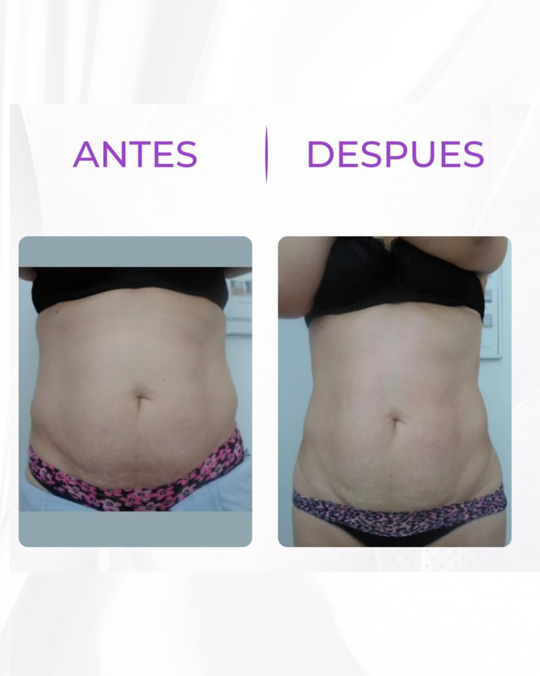 Antes y después · tras 6 sesiones