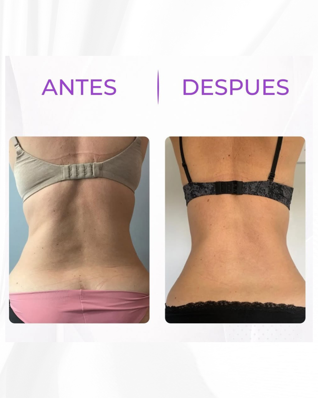 Antes y después · tras 6 sesiones
