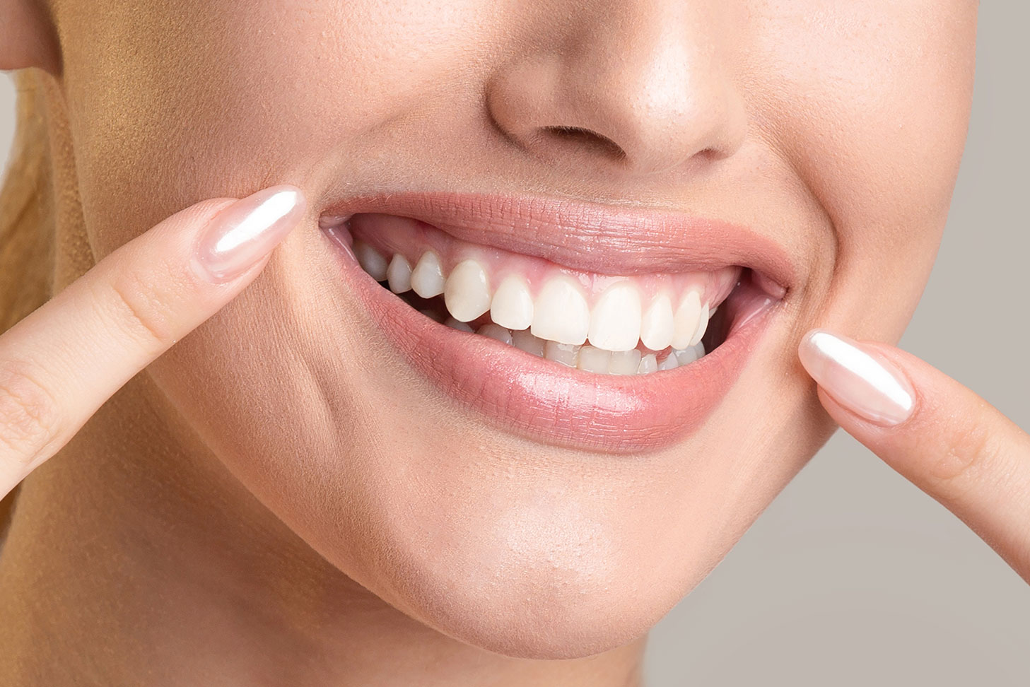 Woman with teeth whitening