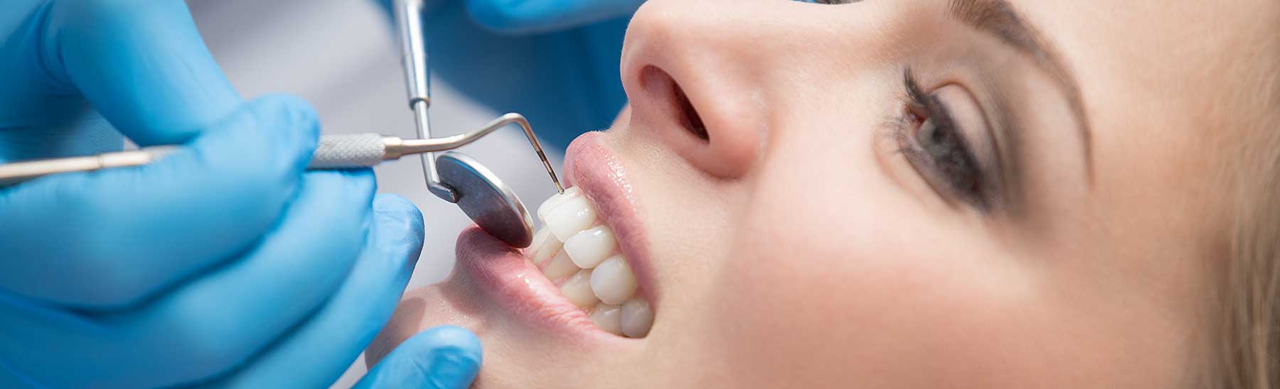 Dentist examining a patient's smile up close