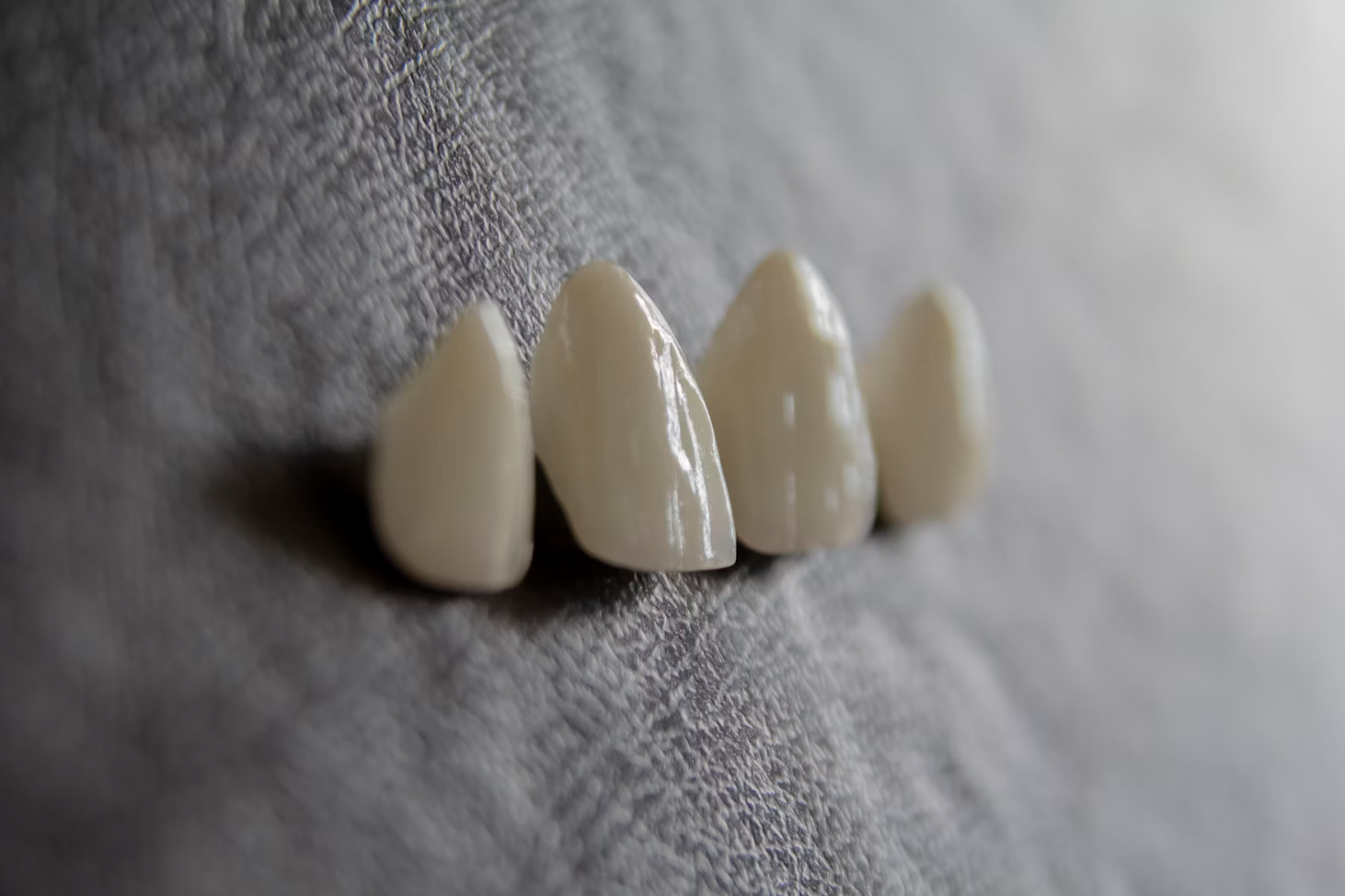 Four ultra-thin porcelain veneer shells showing their delicate translucency and hand-crafted form