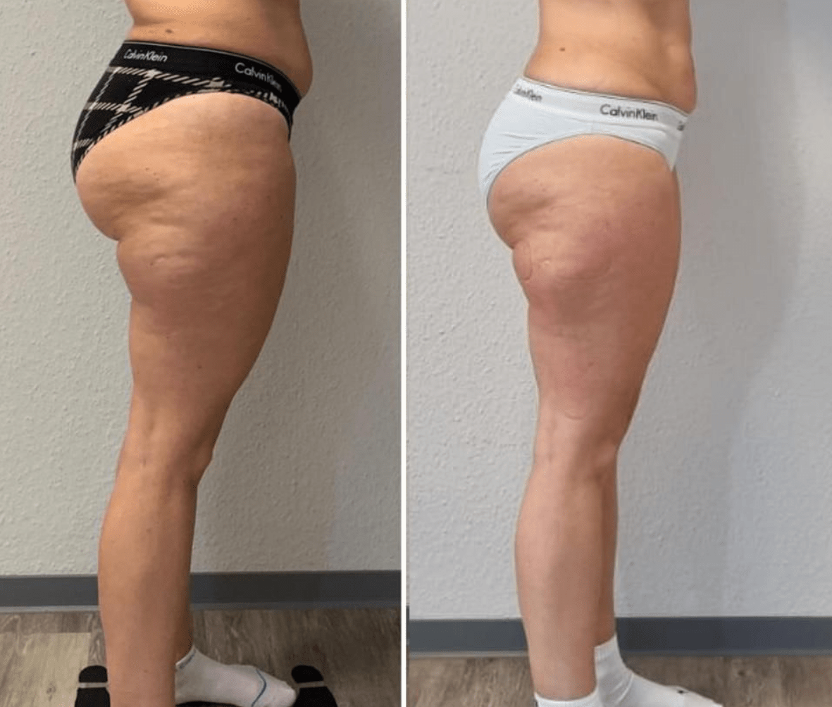 AiL Steyr - Vorher/Nachher 6