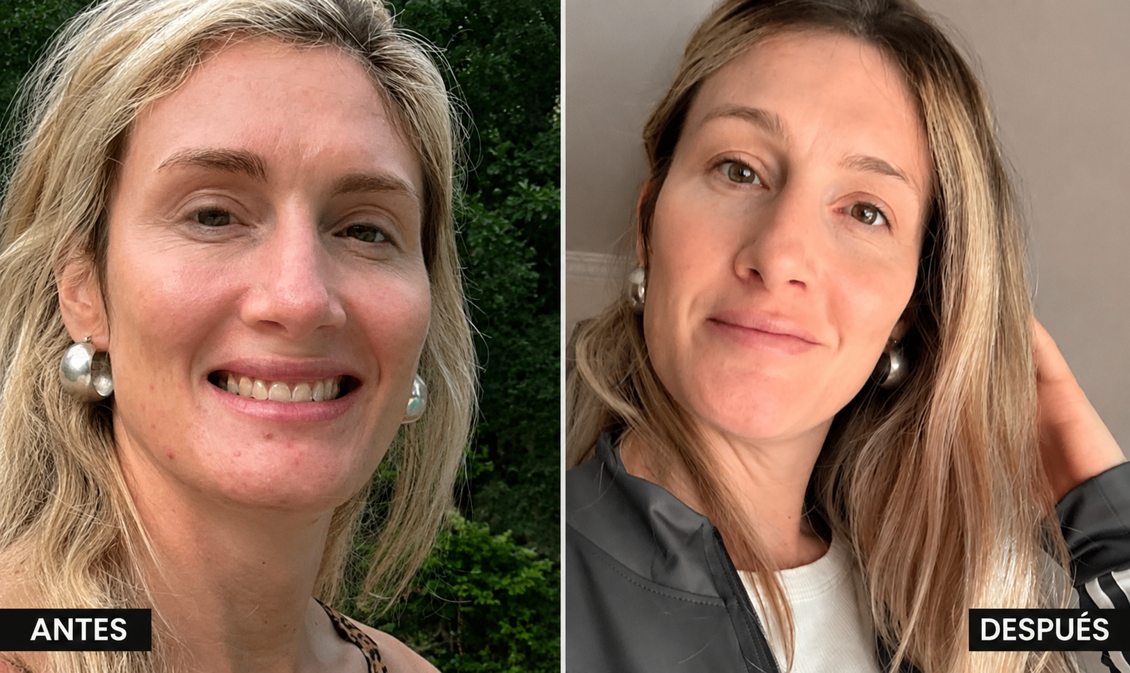 Antes y Después
