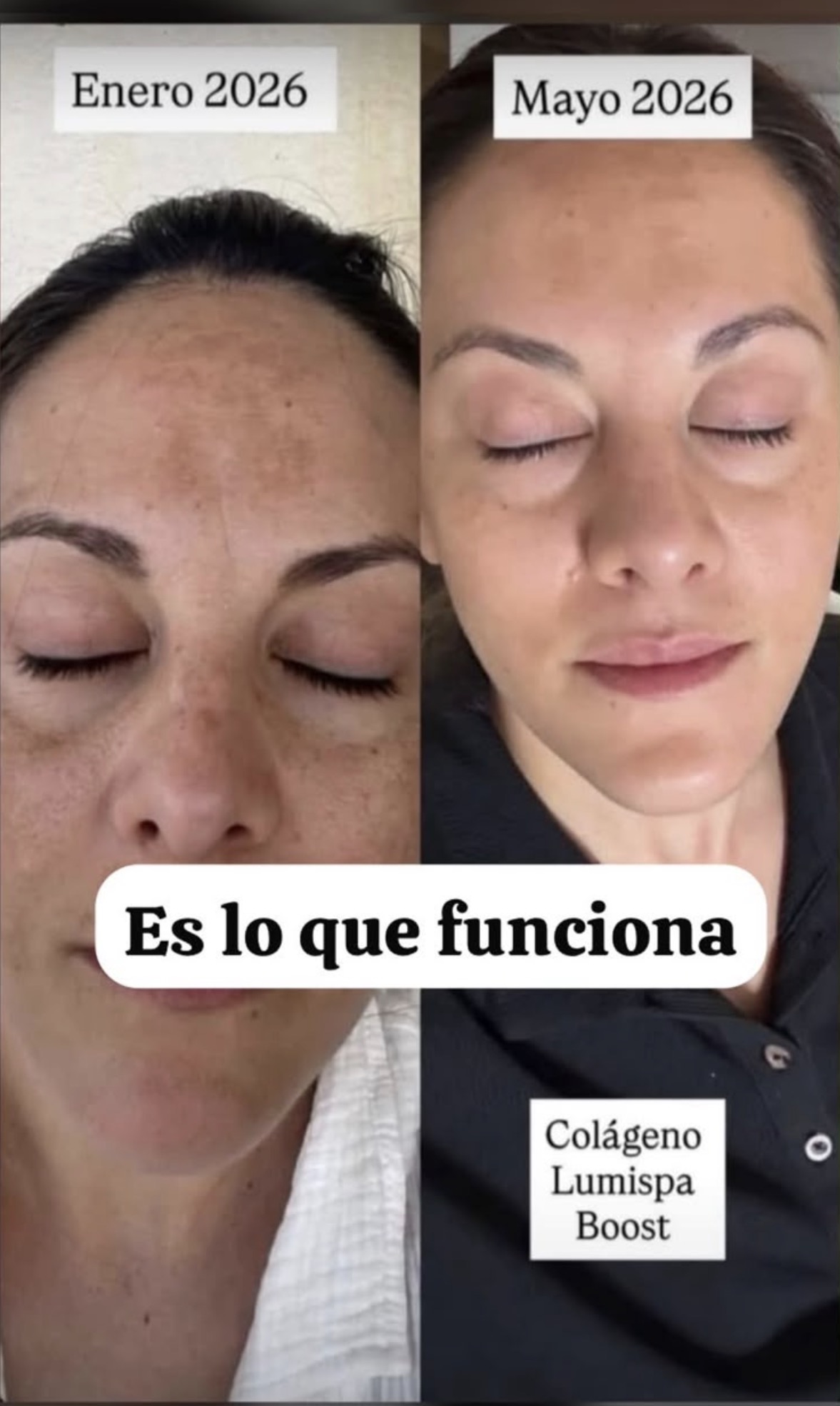 Antes y Después