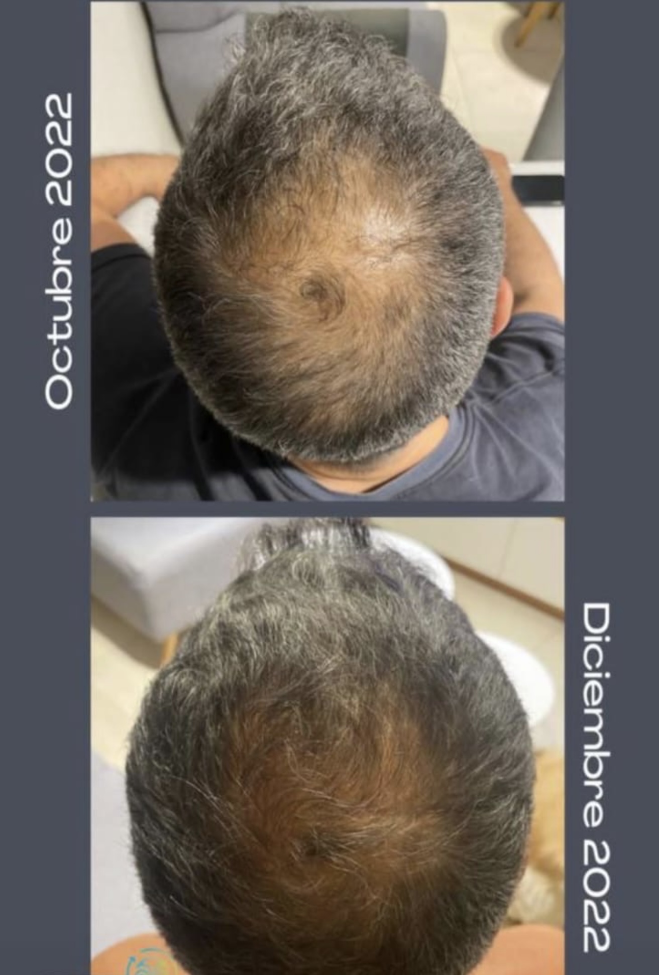 Cabello más fuerte