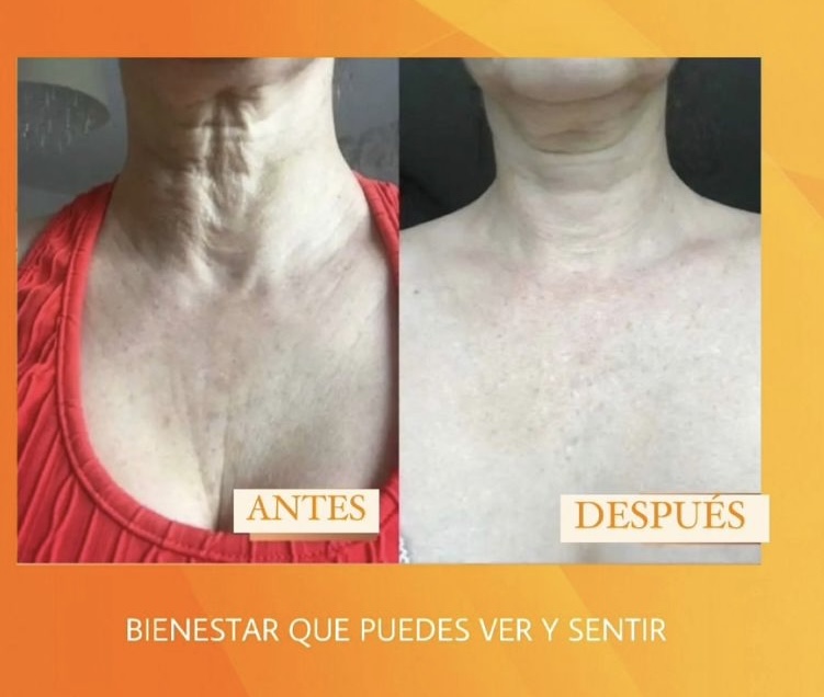 Menos líneas, piel más firme
