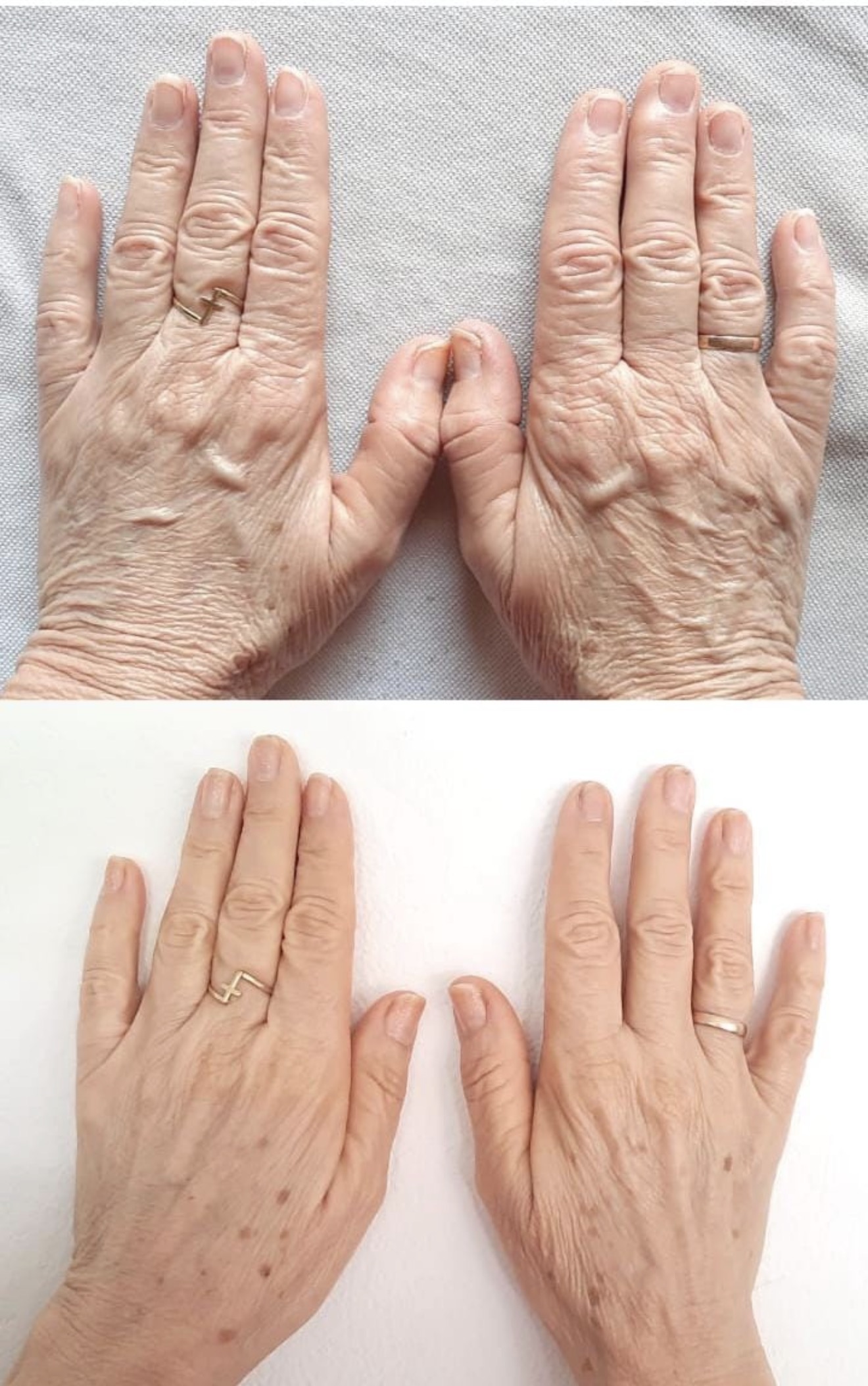 Uñas más resistentes