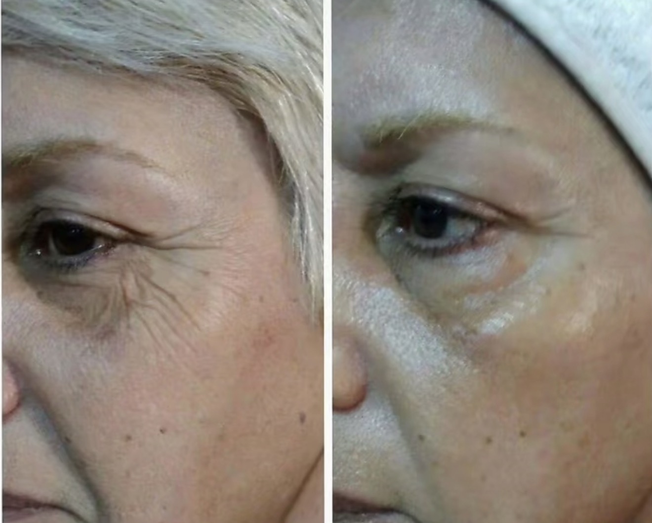 Antes y Después