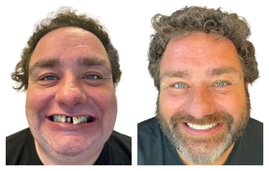Before and After 3