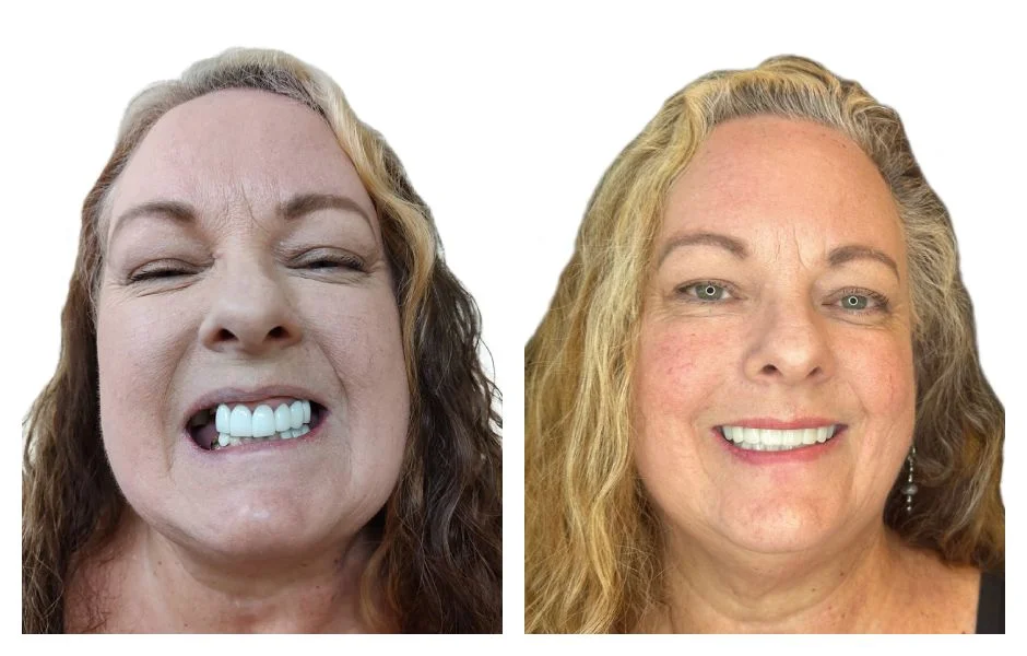 Before and After 4
