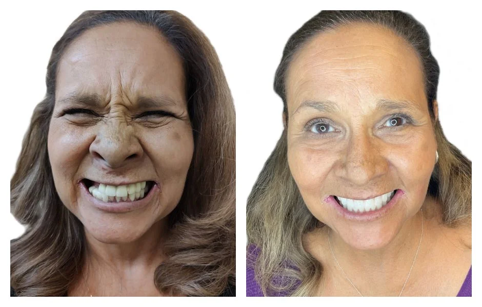 Before and After 2