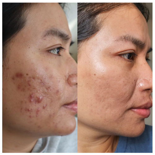 Journey Skincare - Business Photo