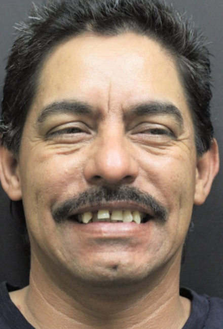 Smile transformation Phoenix AZ