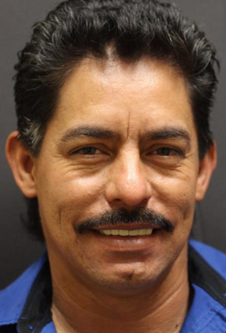 Patient smile transformation