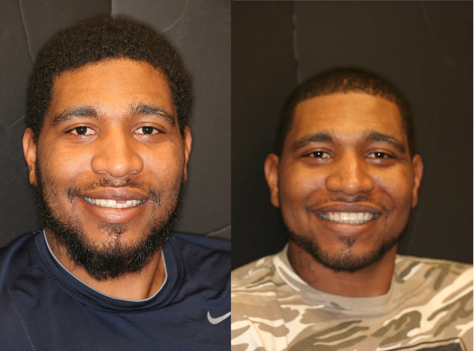 Patient smile result