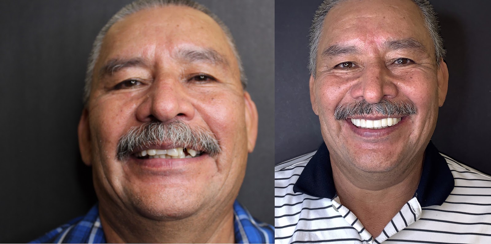 Patient smile result