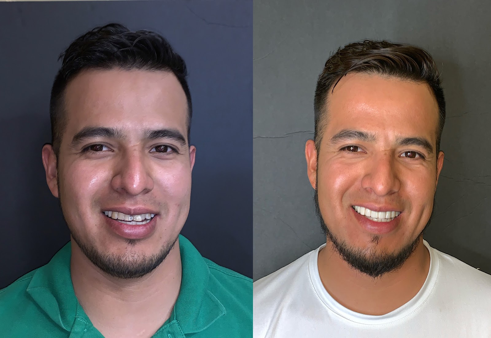Patient smile result