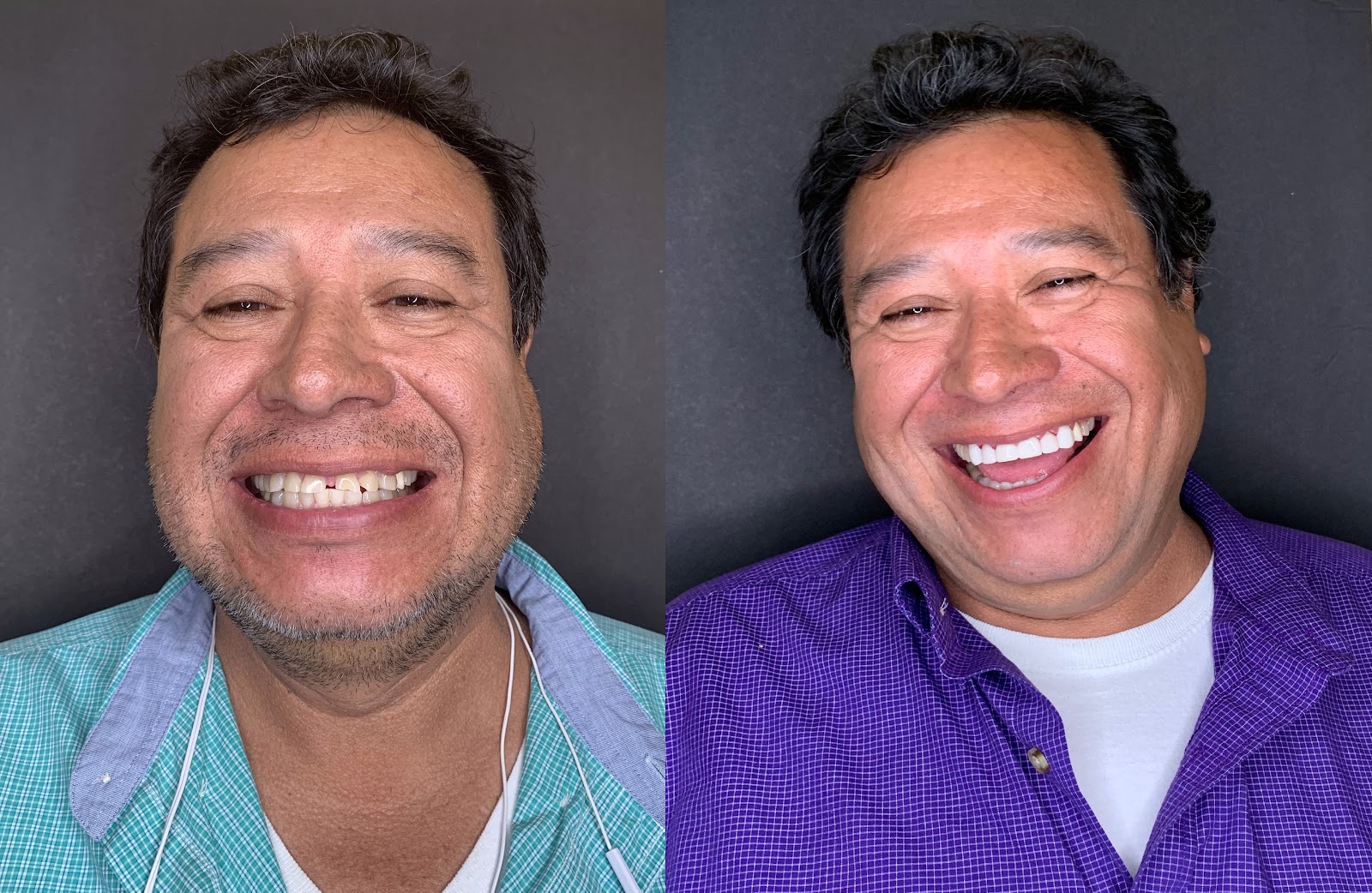 Patient smile result
