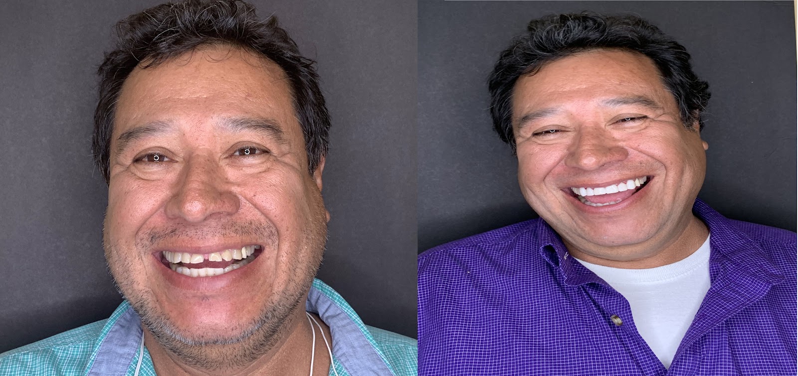 Patient smile result