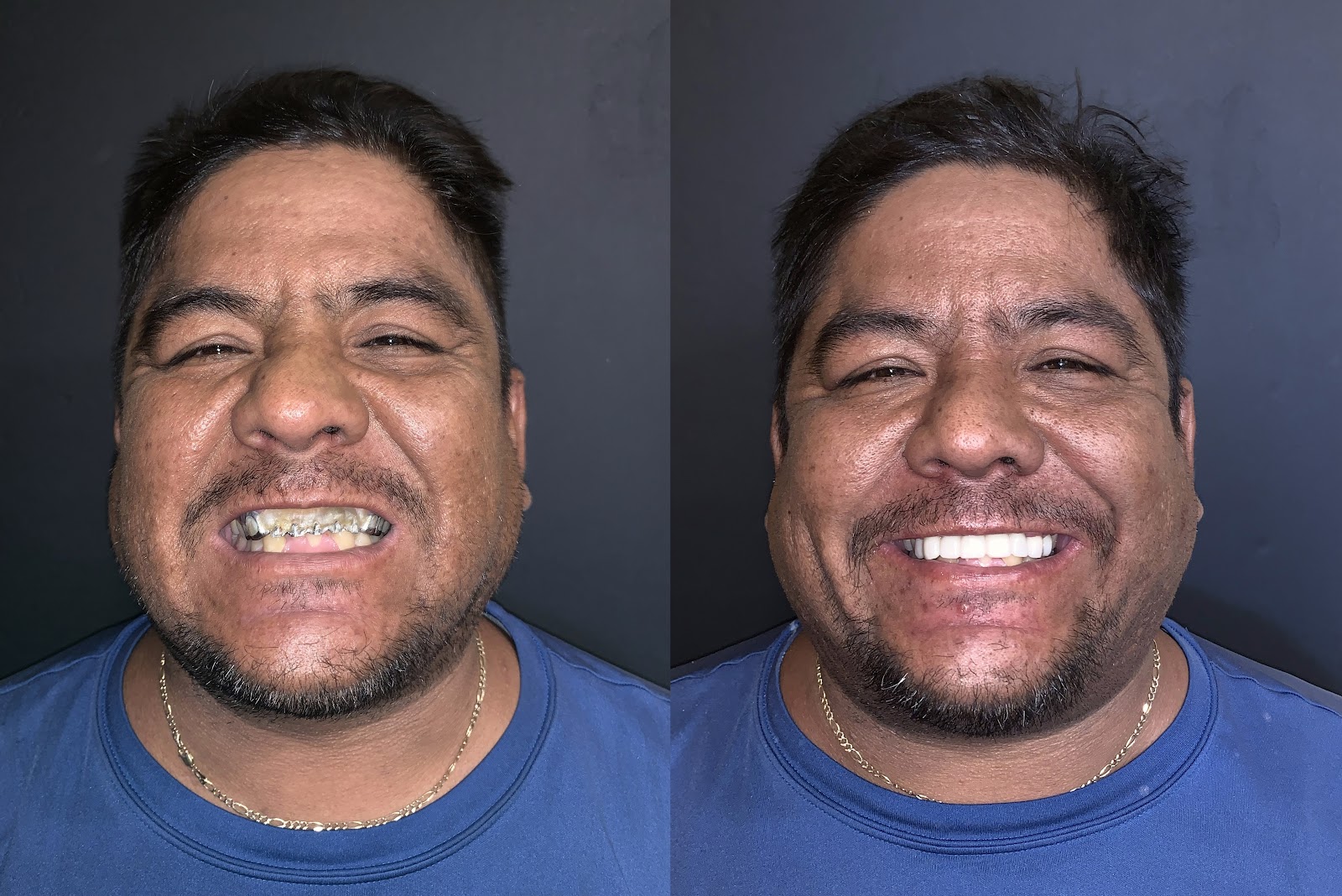 Patient smile result