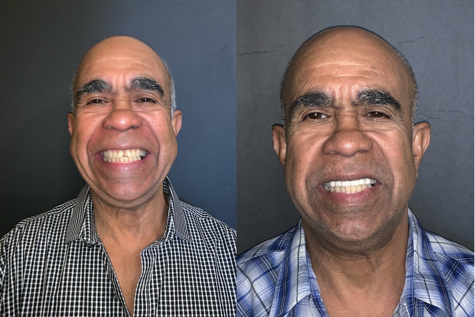 Patient smile result