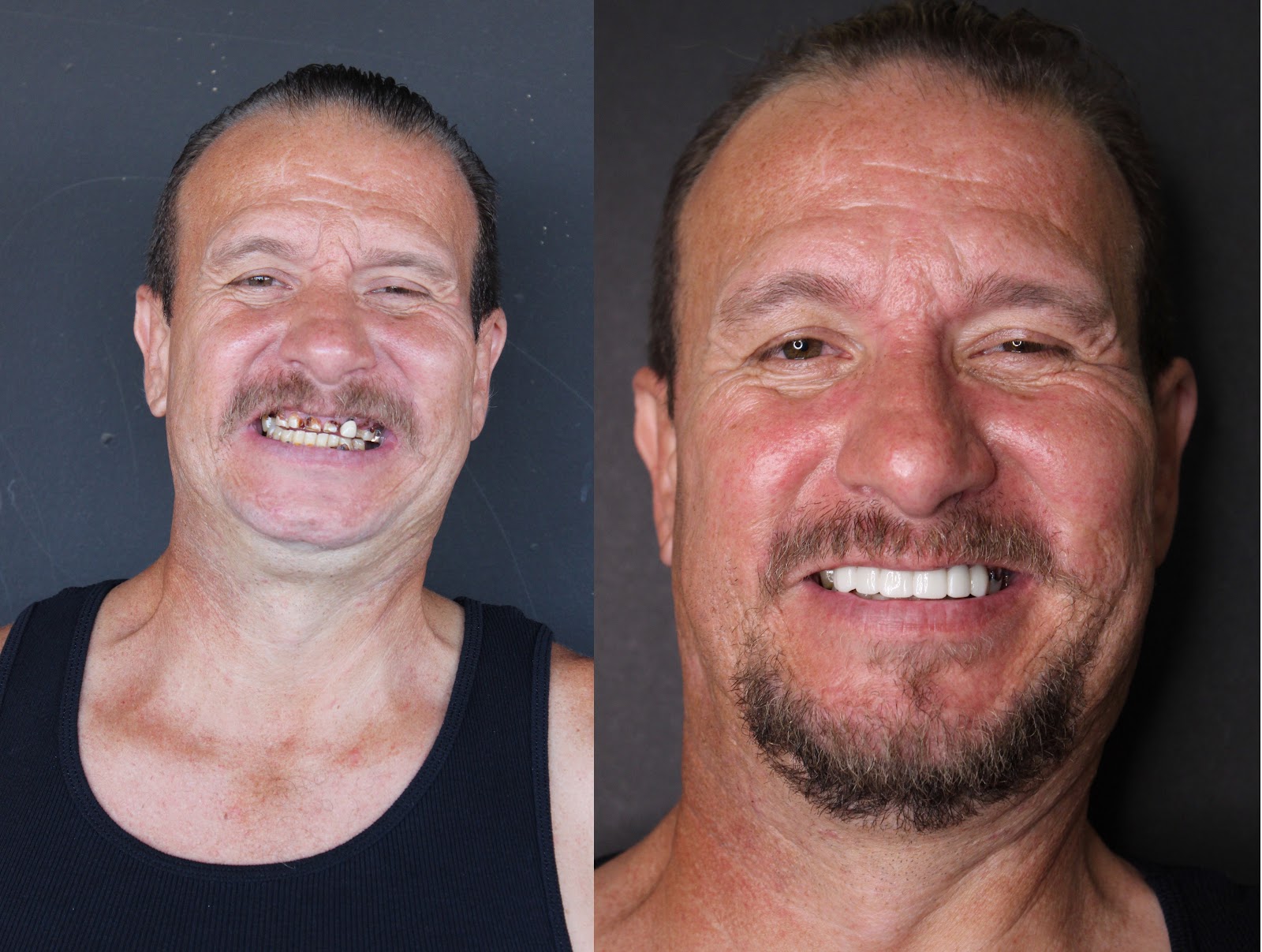 Patient smile result