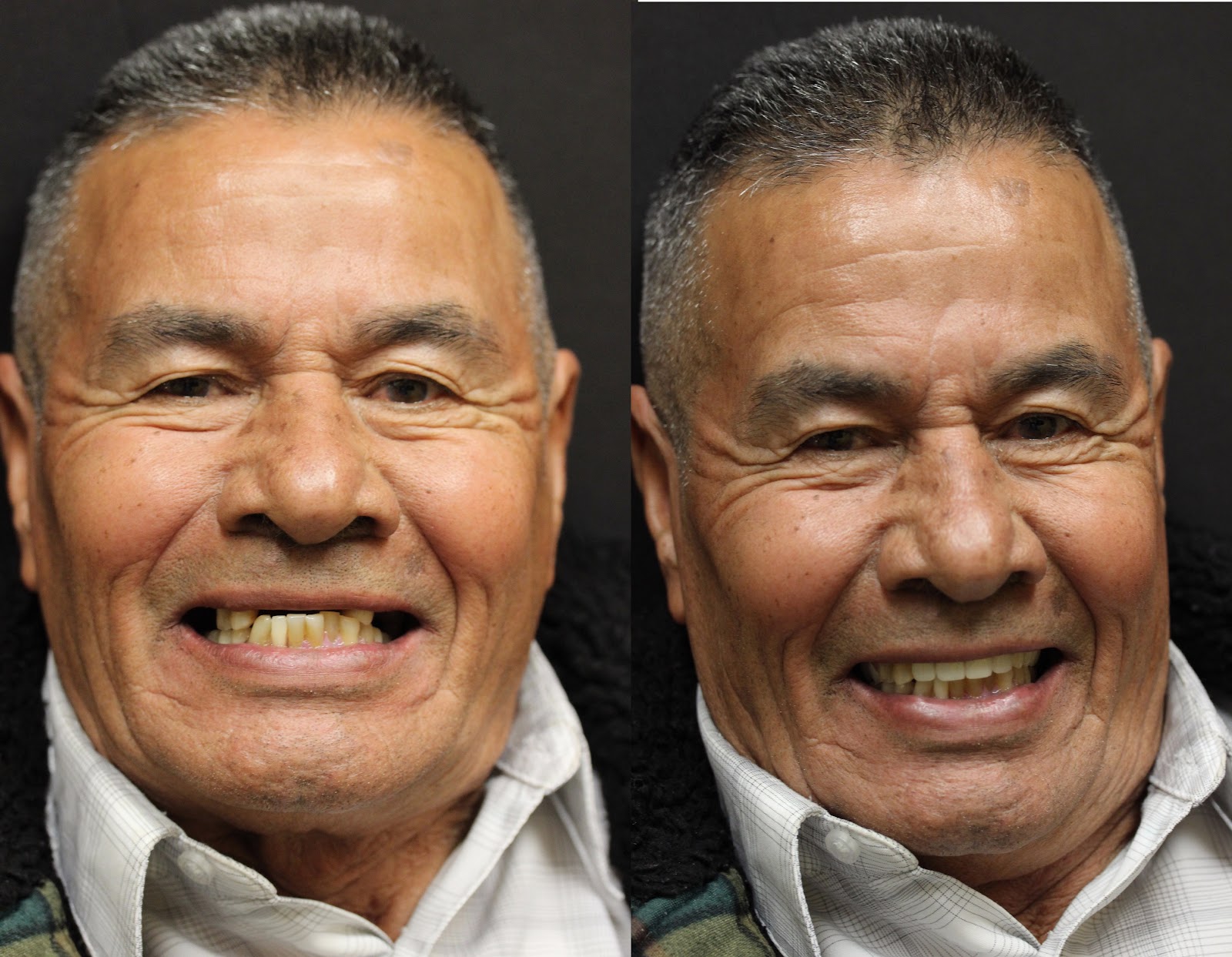Patient smile result