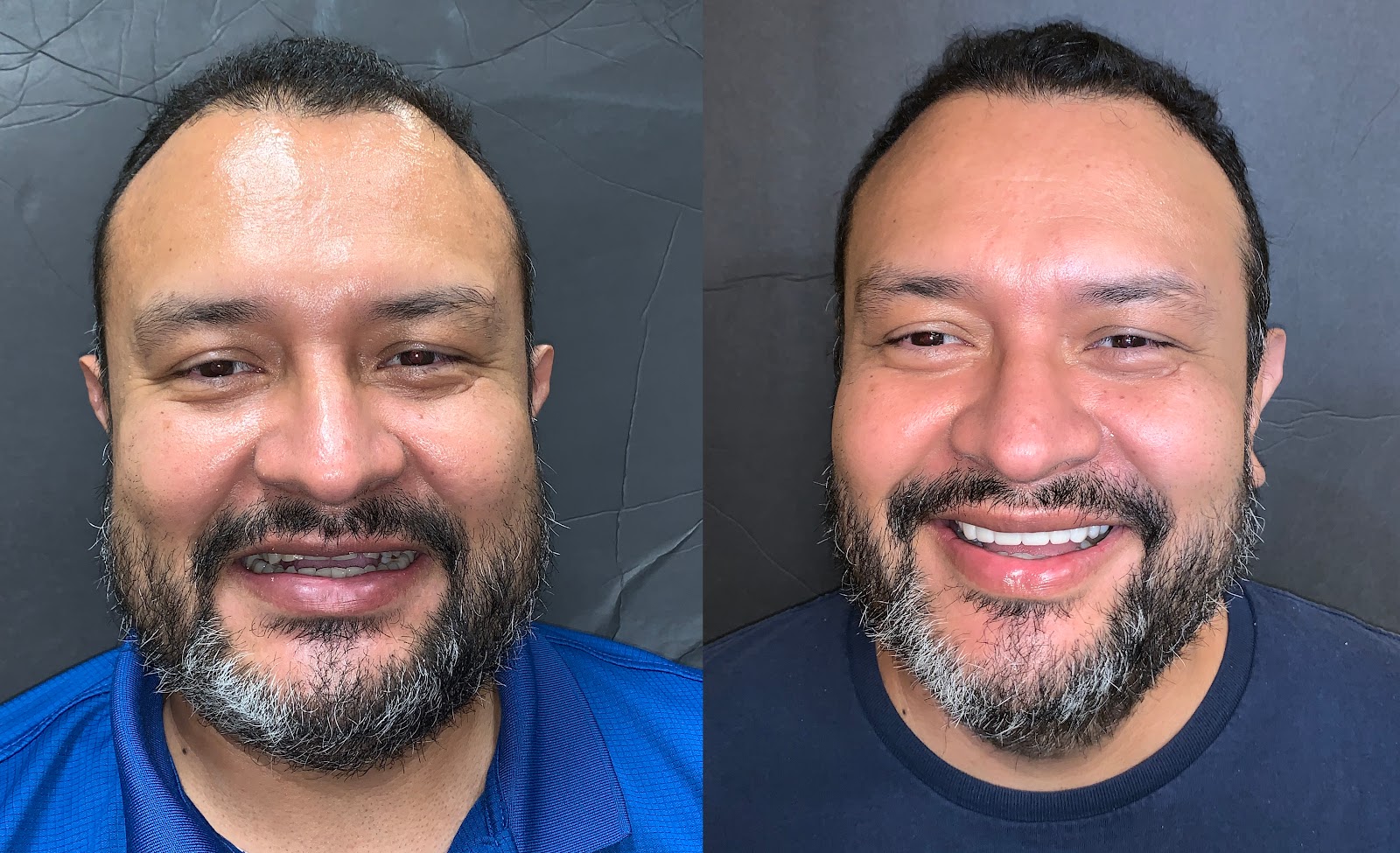 Patient smile result