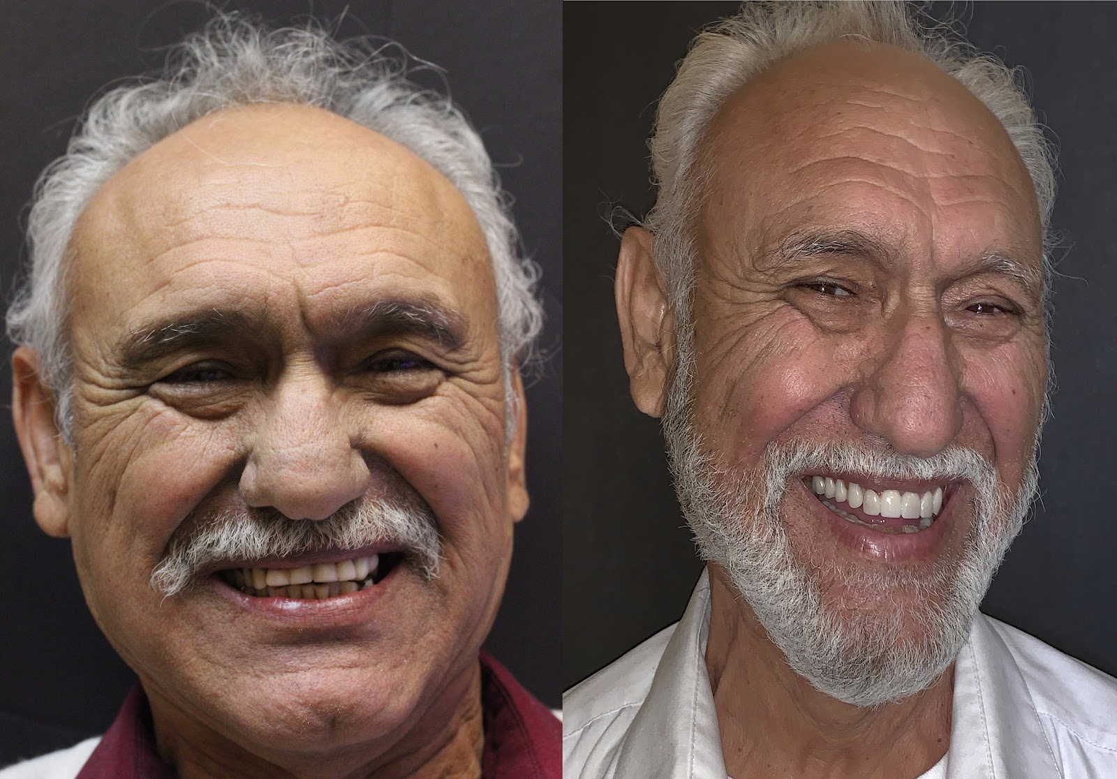 Patient smile result
