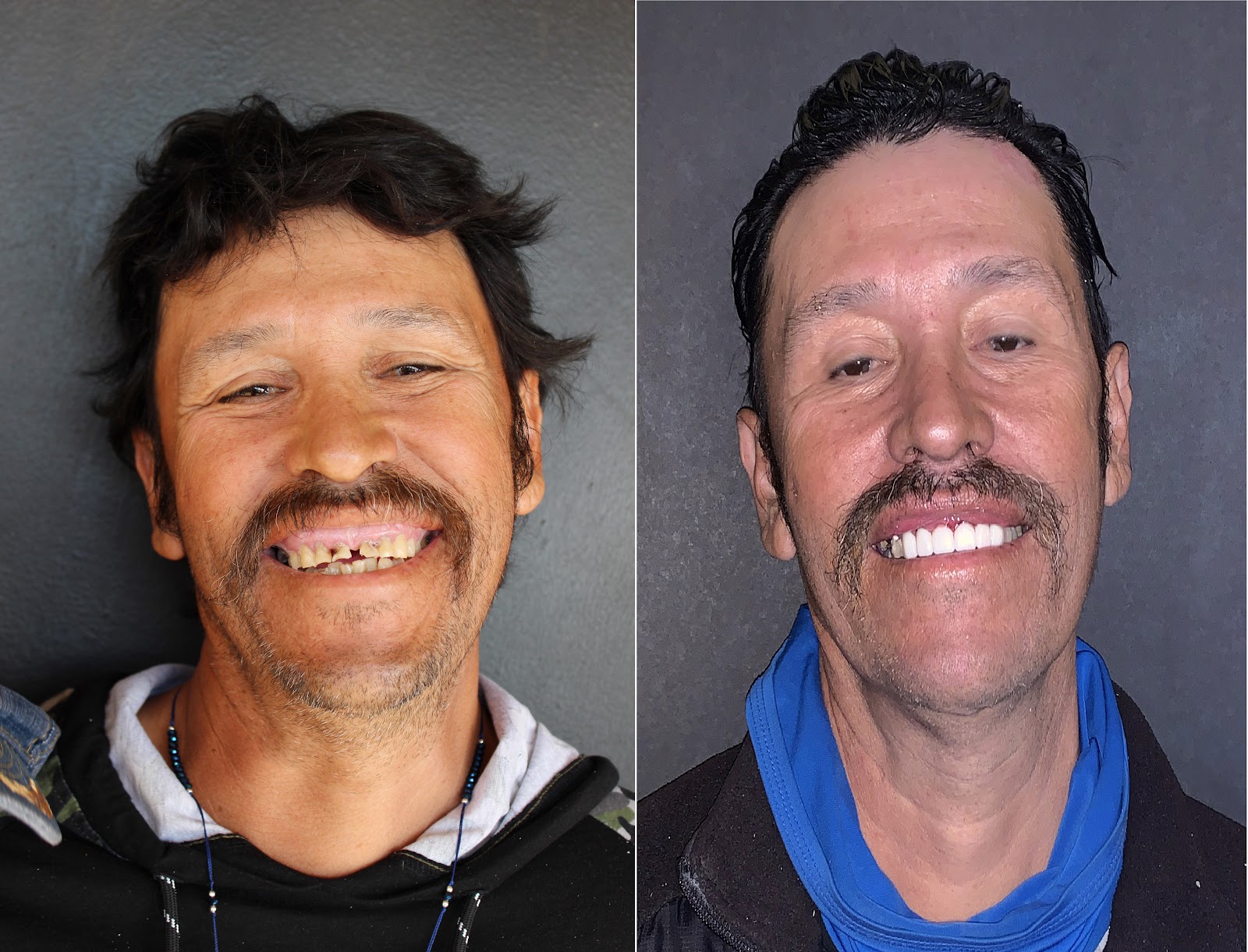 Patient smile result