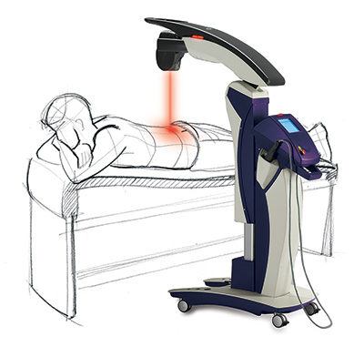 Mapleton, Utah MLS Laser Therapy